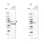 Western blot analysis using Anti-PHGDH antibody HPA024031 (A) shows similar pattern to independent antibody HPA021241 (B).