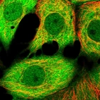 Immunofluorescent staining of human cell line MCF7 shows localization to nucleoplasm, plasma membrane & cytosol.