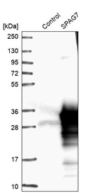 Anti-SPAG7 Antibody