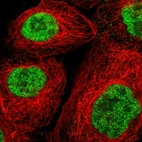 Immunofluorescent staining of human cell line A-431 shows localization to nucleoplasm.