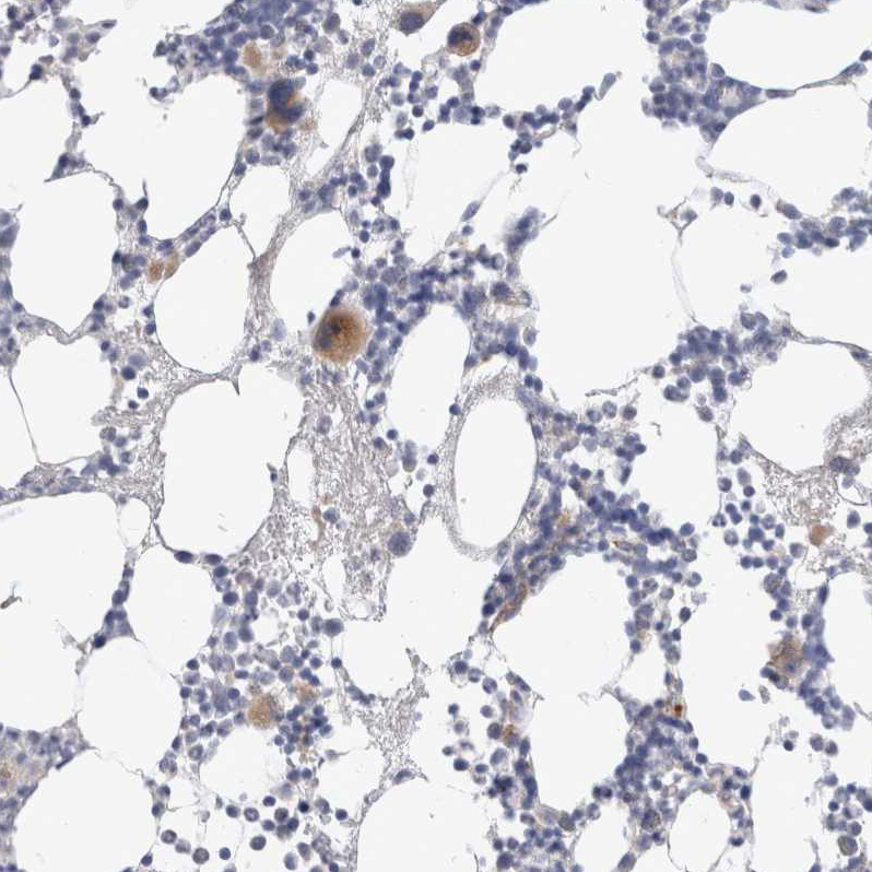 Anti-HPGDS Antibody