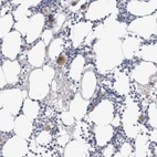 Anti-HPGDS Antibody