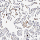 Immunohistochemical staining of human lung shows weak to moderate cytoplasmic positivity in macrophages.