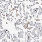Immunohistochemical staining of human lung shows weak to moderate cytoplasmic positivity in macrophages.