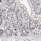 Immunohistochemical staining of human small intestine shows strong cytoplasmic positivity in lymphoid cells.