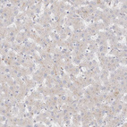 Immunohistochemical staining of human liver shows no positivity in hepatocytes as expected.