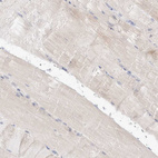 Immunohistochemical staining of human skeletal muscle shows no positivity in myocytes as expected.