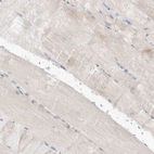 Immunohistochemical staining of human skeletal muscle shows no positivity in myocytes as expected.