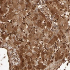 Anti-MST1 Antibody