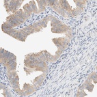 Immunohistochemical staining of human fallopian tube shows high expression.
