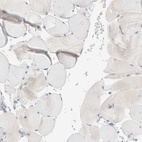 Immunohistochemical staining of human skeletal muscle shows low expression as expected.