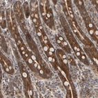 Anti-ABHD11 Antibody