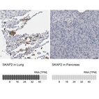 Anti-SKAP2 Antibody