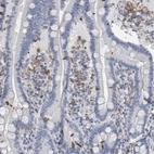 Immunohistochemical staining of human duodenum shows moderate cytoplasmic positivity in lymphoid cells.