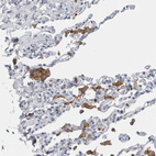 Immunohistochemical staining of human lung shows moderate cytoplasmic positivity in macrophages.