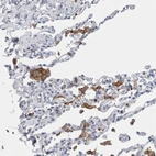 Immunohistochemical staining of human lung shows moderate cytoplasmic positivity in macrophages.