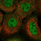 Immunofluorescent staining of human cell line A-431 shows localization to nucleoplasm & cytosol.