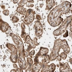 Immunohistochemical staining of human placenta shows moderate cytoplasmic positivity in trophoblastic cells.