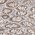 Immunohistochemical staining of human rectum shows moderate cytoplasmic positivity in glandular cells.