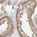 Immunohistochemical staining of human testis shows moderate cytoplasmic positivity in cells in seminiferous ducts.