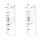 Western blot analysis using Anti-OTUD6B antibody HPA024046 (A) shows similar pattern to independent antibody HPA024503 (B).
