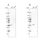 Western blot analysis using Anti-OTUD6B antibody HPA024046 (A) shows similar pattern to independent antibody HPA024503 (B).
