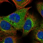 Immunofluorescent staining of human cell line A-431 shows localization to cytosol & the Golgi apparatus.