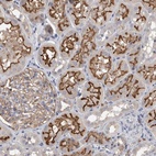 Anti-DCTN6 Antibody
