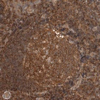 Anti-PFDN4 Antibody