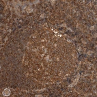 Anti-PFDN4 Antibody