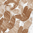 Immunohistochemical staining of human skeletal muscle shows moderate cytoplasmic-nuclear positivity in myocytes.