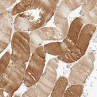 Immunohistochemical staining of human skeletal muscle shows moderate cytoplasmic-nuclear positivity in myocytes.
