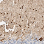 Immunohistochemical staining of human cerebellum shows strong cytoplasmic positivity in Purkinje cells and nuclear positivity in molecular layer cells.
