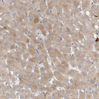 Immunohistochemical staining of human liver shows moderate cytoplasmic positivity in hepatocytes.