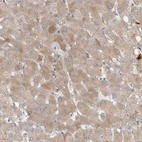 Immunohistochemical staining of human liver shows moderate cytoplasmic positivity in hepatocytes.