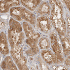 Anti-CFI Antibody