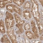 Immunohistochemical staining of human kidney shows moderate cytoplasmic positivity in cells in tubules.
