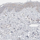 Immunohistochemical staining of human skin shows very weak cytoplasmic positivity in squamous epithelial cells.