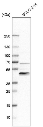 Western blot analysis in human cell line SCLC-21H.