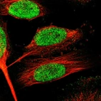 Immunofluorescent staining of human cell line U-251 MG shows localization to nucleus.