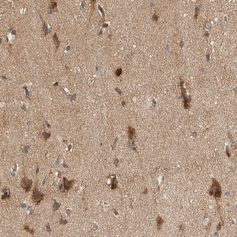 Anti-PXK Antibody