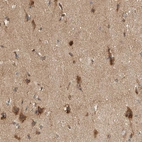 Anti-PXK Antibody