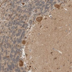 Immunohistochemical staining of human cerebellum shows strong cytoplasmic positivity in Purkinje cells.