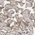 Immunohistochemical staining of human placenta shows moderate cytoplasmic positivity in trophoblastic cells.