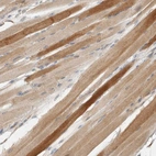 Immunohistochemical staining of human skeletal muscle shows moderate cytoplasmic positivity in myocytes.