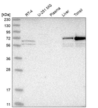 Western blot analysis in human cell line RT-4, human cell line U-251 MG, human plasma, human liver tissue and human tonsil tissue.