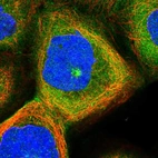 Immunofluorescent staining of human cell line A-431 shows localization to plasma membrane, cytosol & microtubule organizing center.