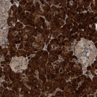 Immunohistochemical staining of human pancreas shows high expression.