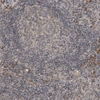 Immunohistochemical staining of human lymph node shows low expression as expected.