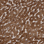 Immunohistochemical staining of human liver shows strong cytoplasmic positivity in hepatocytes.